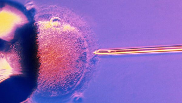 Những điều cần biết về thụ tinh trong ống nghiệm