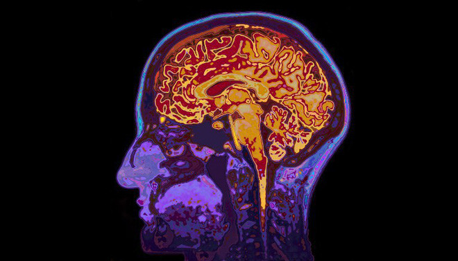 Hiện tượng vi chimera nam giới xuất hiện ở nhiều phần của não bộ.