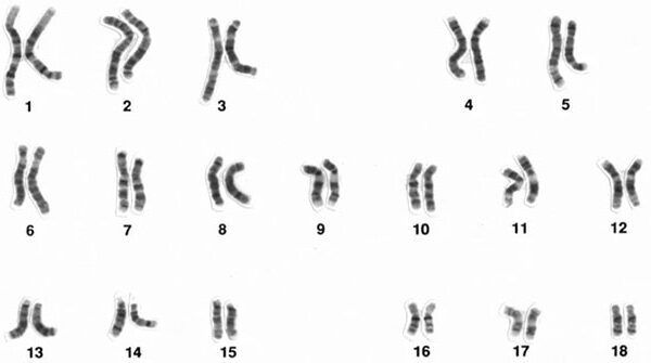 Thuốc lá làm tiêu hủy nhiễm sắc thể Y ở đàn ông