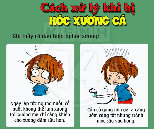 Khi thấy dấu hiệu bị hóc xương thì lập tức ngừng nuốt Cách xử lý "chuẩn không cần chỉnh" khi bị hóc xương cá